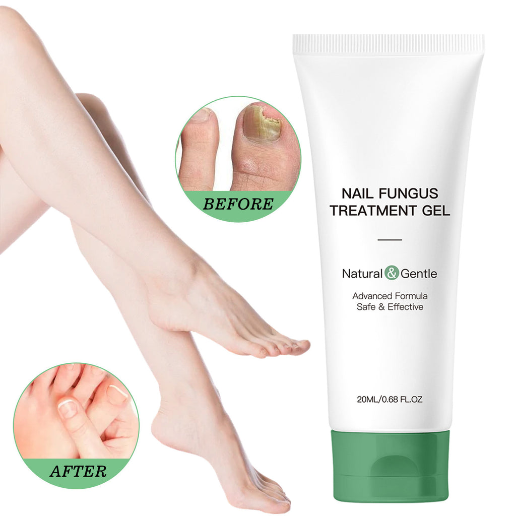 Herbal Foot & Hand Repair Gel – Deep Moisturizing Cream